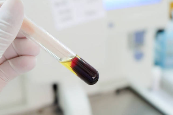 d3f933704b355a608b54c4c1c8ea0b5b.png 熊猫血父母通常是什么血型