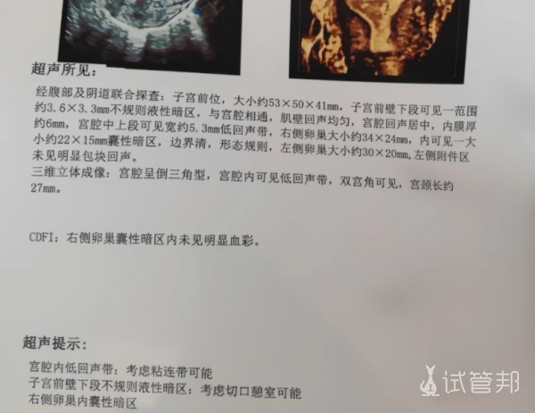 ff5bb2619e065372bc55d565b76c7b61.png 宫颈粘连手术是什么体验