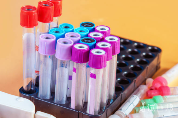 0b57d3bc5f355864a72f4b0ed410efe0.png rh阴性血遗传规律是怎样的