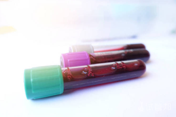 21fef58c9d45876aa9cae5d06b2f6d0a.png Rh阴性血缺少什么抗原