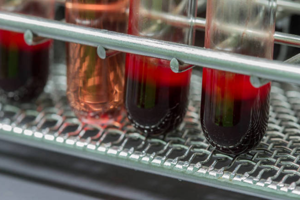 4cb29e78f30afb49fdffd67c96fbc019.png 熊猫血指的是什么