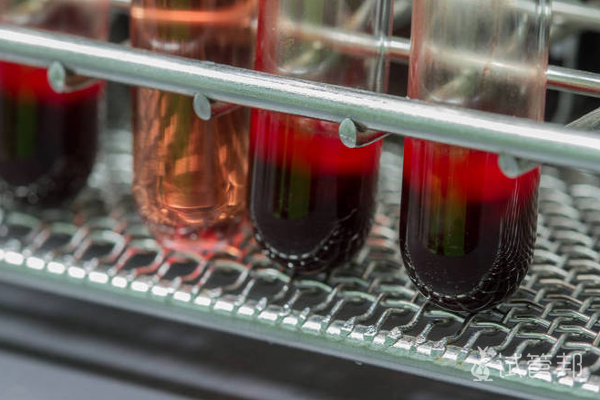 7d7d5b52e32f4e32a29aedd54d112014.png Rh阴性血指的是什么