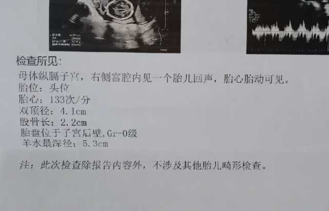 单角+残角子宫姐妹别怕我的试管逆袭路来给你打气