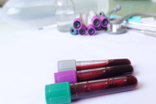 28c8d9ac0238b163b37a9d31a2fb5406.png rh阴性血能输血给任意人吗