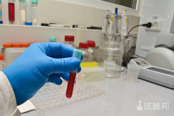 60fc19df91bc6083aece06db6aea7828.png rh阴性血可以接受rh阳性血吗