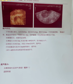 盆腔粘连怎么治疗？要手术吗