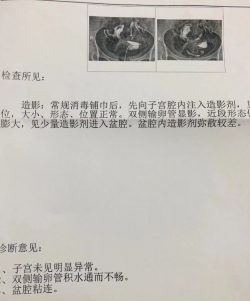 盆腔粘连做了松解手术，希望术后能顺利怀孕