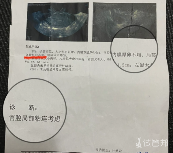 d3a36810d949851b137e5f4f3afc3731.png 盆腔粘连怎么治疗