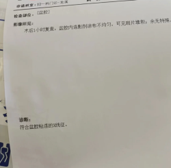 盆腔粘连影响怀孕吗？试管移植前要不要处理