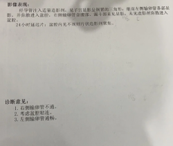 盆腔粘连、输卵管堵塞，怪不得怀不上