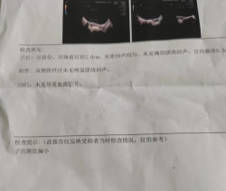 月经不来查出子宫小是怎么回事？崩溃了