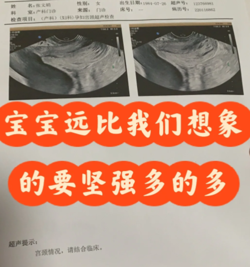 37岁做试管生了双胞胎陷入了焦虑