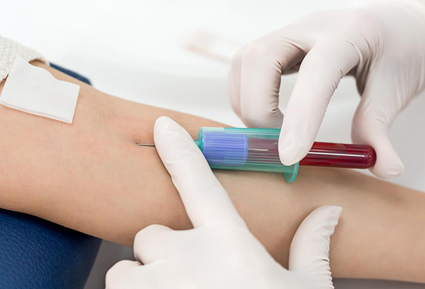 绒毛膜促性腺激素多少是怀孕