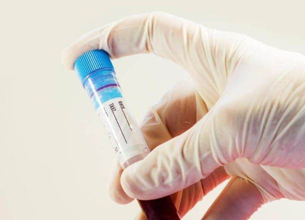 促人绒毛膜促性腺激素高了怎么办