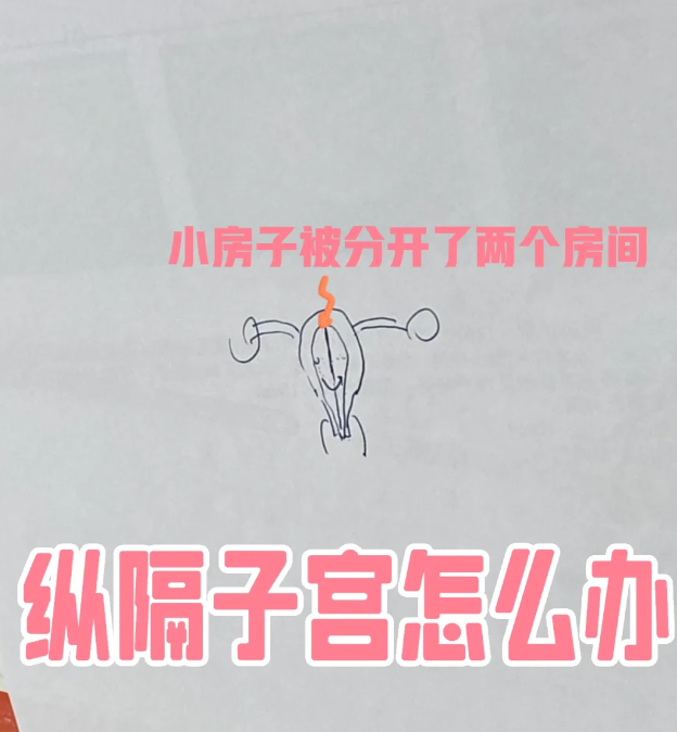 孕8周查出纵隔子宫，保胎中