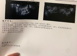 子宫小、姨妈出走，姐妹们减肥真的要适度啊