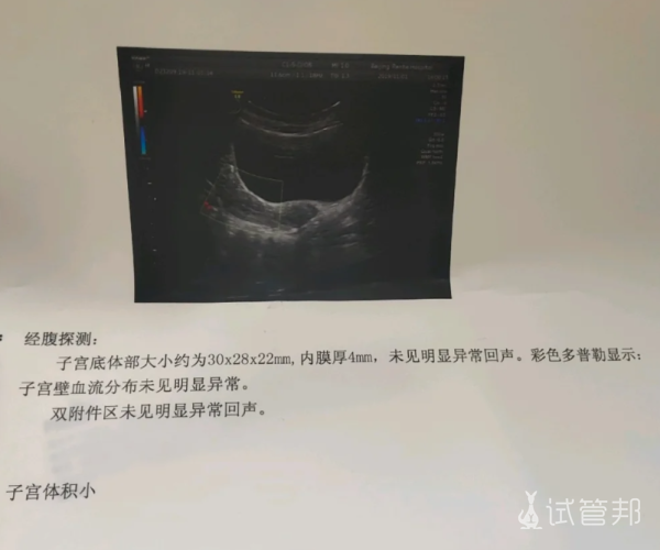 b1fde2246f48334ead618052dfd64401.png 子宫小是怎么回事