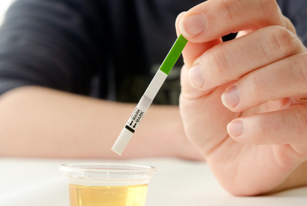 b2e9e5c00bc5f9b6d58cf9b5fb71403a.png 人绒毛膜促性腺激素检测试纸怎么看