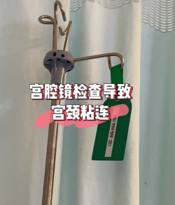 万万没想到，做个宫腔镜检查得了宫颈粘连