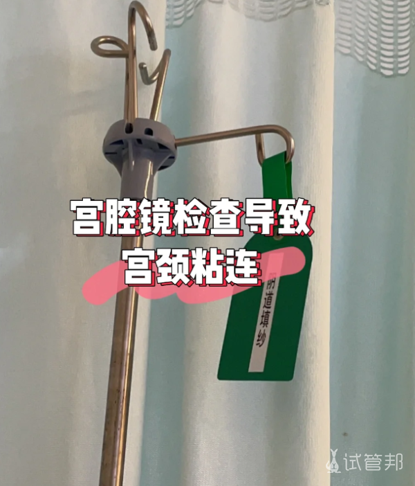 dd4428a77fec1cb9a9af29e9df77827f.png 做个宫腔镜检查得了宫颈粘连