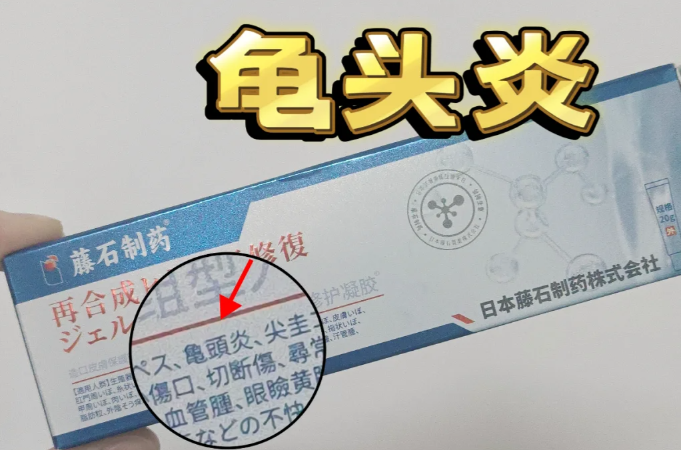 出现龟头炎救星来啦