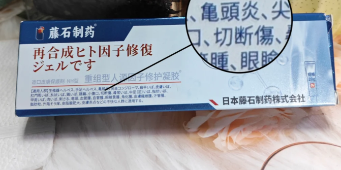 霉菌性龟头炎可以这样治疗