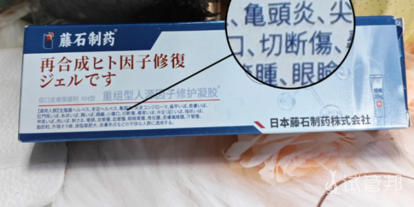 90c009554496e898c4990f686e010a59.png 霉菌性龟头炎可以这样治疗