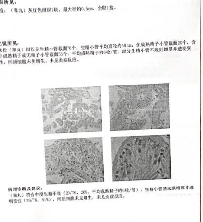 老公确诊无精症，我们做试管顺利上岸
