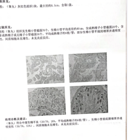 老公确诊无精症，我们做试管顺利上岸