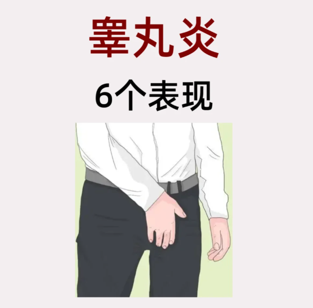 睾丸炎有什么表现如何自查