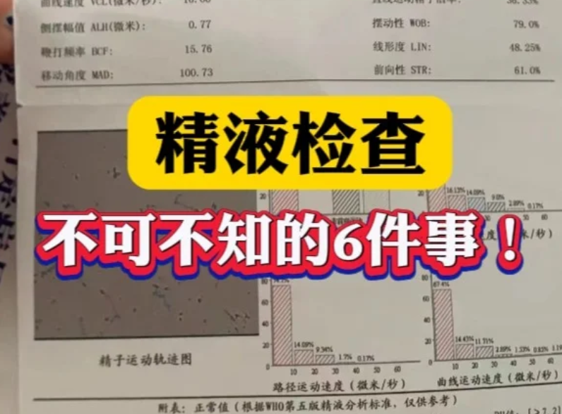 7ba0e732cb1563650ef9c753bdf9e2fb.png 关于精液常规检查这6件事要知道