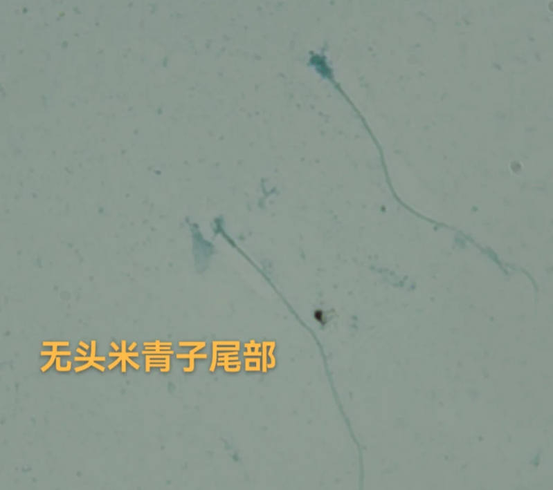 精子畸形率97%备孕一年都没有成功怎么办
