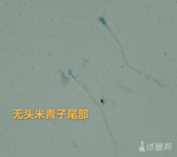 5ac10774174a39dd9f8d2a9642cd799c.png 精子畸形率97%备孕一年都没有成功怎么办