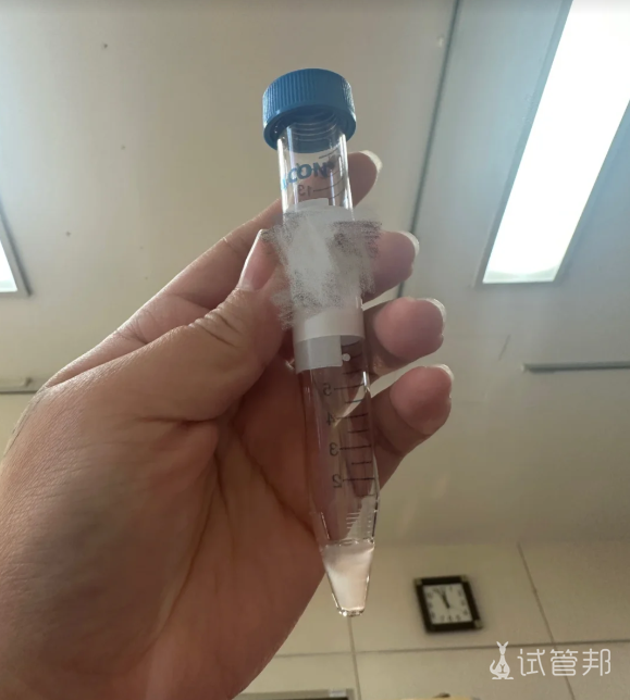 2b8c1dae9edf4a54128d7253ec5f2e8c.png 3分钟教你看懂精液报告单不再一头雾水