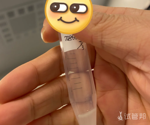 412fcf9f5a5d6e8fdf05fa34d2a0a6f6.png 5分钟自测你的小蝌蚪健康达标了吗