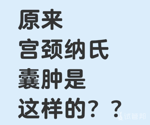 4c305671b3c21dad7142452f599b63f9.png 宫颈纳氏囊肿是什么/