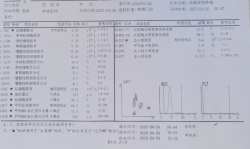 卵巢癌晚期125又一次超过10 了