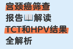 TCT检查和HPV检测结果解读来了