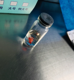 宫颈息肉的8个表现！！姐妹们要多注意