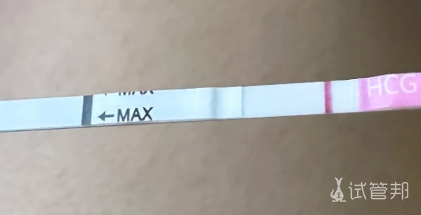 7e5aab35b6a045c3a52887206da30622.png 又要重头开始试管,想想就心累