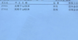 抗精子抗体阳性，我是怎么顺利怀孕的？