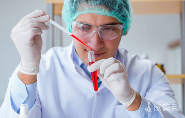 33d48f3026108bd86664a1406983c0cf.png 弓形虫怎么检查