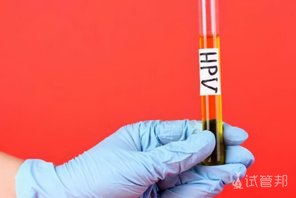 a831074f290947ffb3a25677c21817d1.png 人乳头瘤病毒核酸检测是检查什么