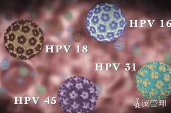 d53452d475bdd174285672f67d910271.png 人乳头瘤病毒hpv正常值是多少