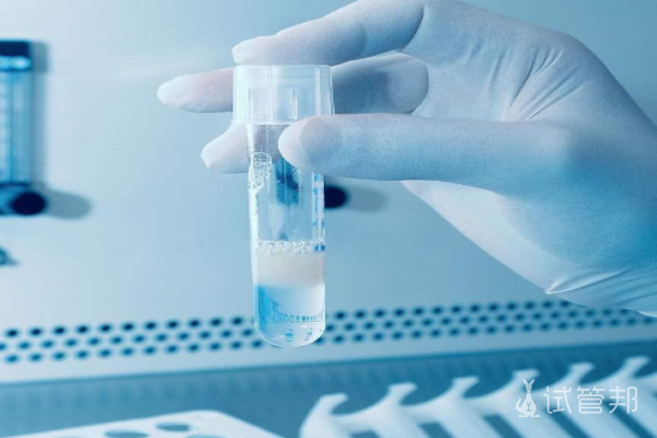 33017c9199b18faea8522a8e339428f1.png 精液颜色正常是怎样的