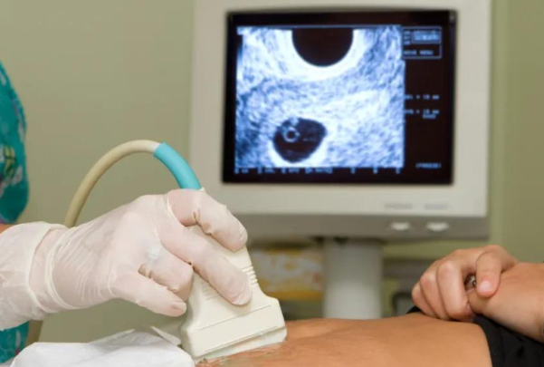 33309cd6f64c719852fbe1f61af09d68.png 排卵监测做什么项目最准确