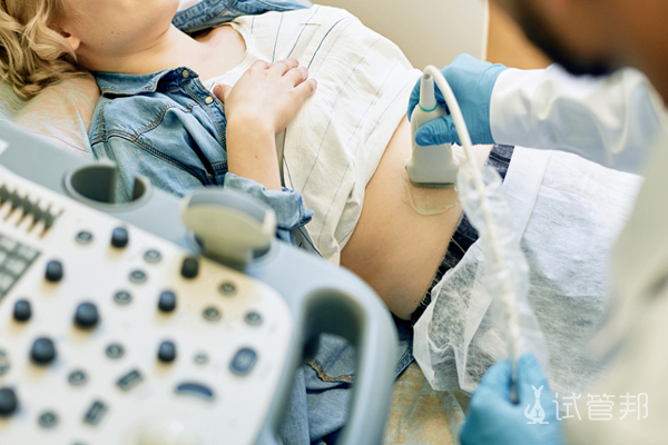 8baef1f8f6aceb5fe7a15faa304de515.png 基础卵泡多就是多囊卵巢吗