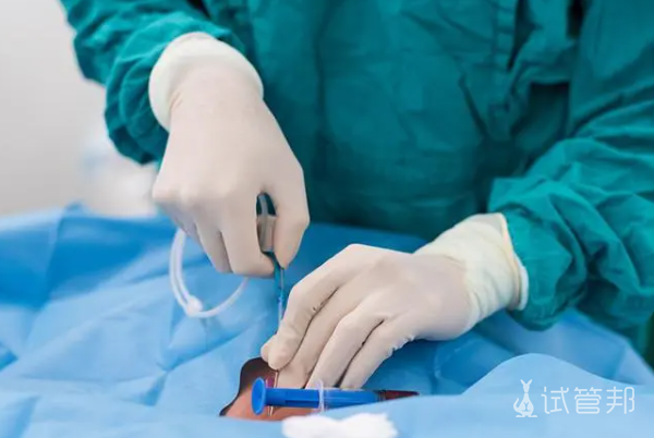 1a43fe31cdffdeb1d3d92d785f676c21.png 取卵费用大概多少