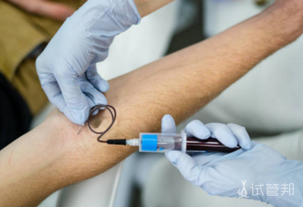 9d00d495238c9d88fc14ad582a4e7903.png 性染色体异常有几种情况