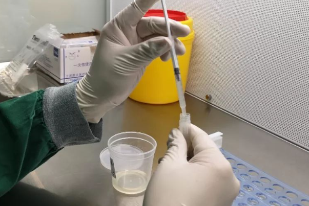 12e42e5c37e269f12aa6a771a4b5b687.png 抗精子抗体阴性对怀孕有影响吗